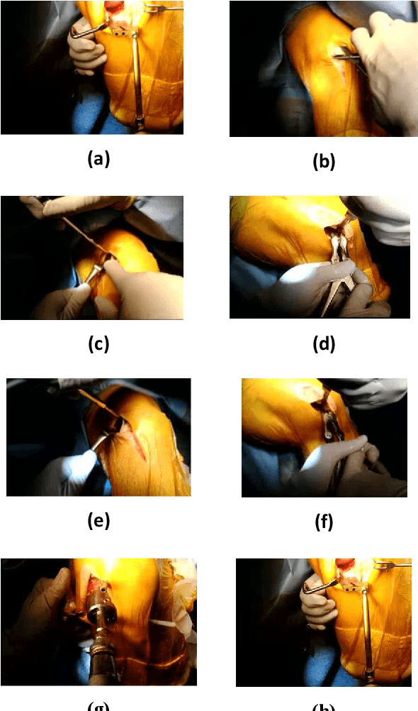 Figure 3 for Real-time Surgical Tools Recognition in Total Knee Arthroplasty Using Deep Neural Networks