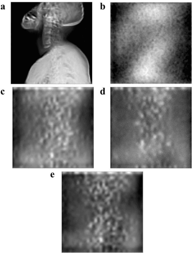Figure 4 for Generative Adversarial Network Based Synthetic Learning and a Novel Domain Relevant Loss Term for Spine Radiographs