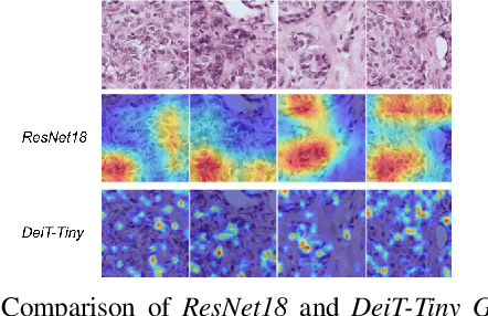 Figure 2 for A comparative study between vision transformers and CNNs in digital pathology