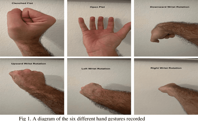 Figure 1 for Decision Forest Based EMG Signal Classification with Low Volume Dataset Augmented with Random Variance Gaussian Noise