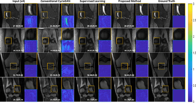 Figure 4 for Unpaired Deep Learning for Accelerated MRI using Optimal Transport Driven CycleGAN