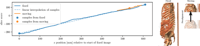 Figure 1 for Efficient Prealignment of CT Scans for Registration through a Bodypart Regressor