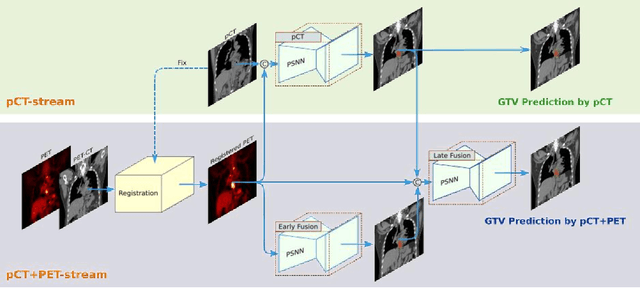 Figure 4 for Multi-institutional Validation of Two-Streamed Deep Learning Method for Automated Delineation of Esophageal Gross Tumor Volume using planning-CT and FDG-PETCT