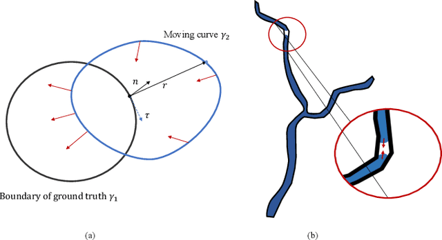 Figure 1 for An Elastic Interaction-Based Loss Function for Medical Image Segmentation