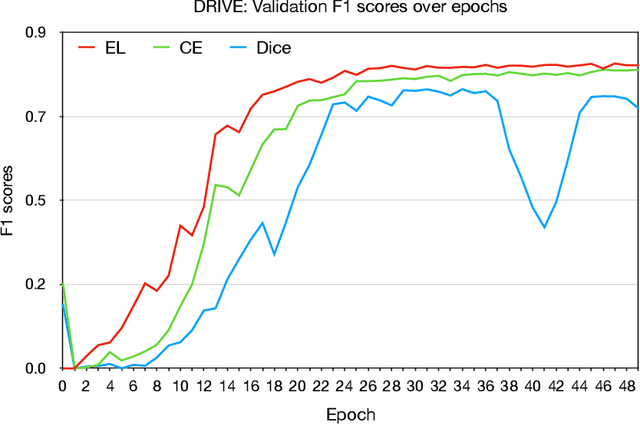 Figure 4 for An Elastic Interaction-Based Loss Function for Medical Image Segmentation