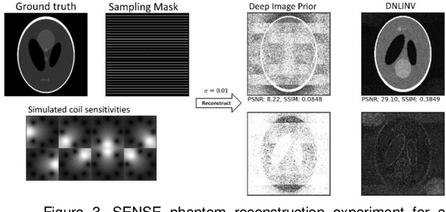 Figure 3 for Scan-specific Self-supervised Bayesian Deep Non-linear Inversion for Undersampled MRI Reconstruction