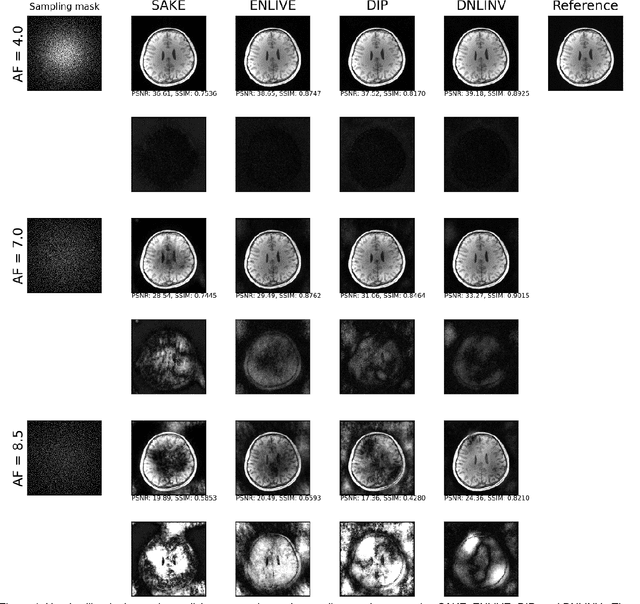 Figure 4 for Scan-specific Self-supervised Bayesian Deep Non-linear Inversion for Undersampled MRI Reconstruction
