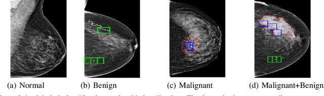 Figure 1 for A dual branch deep neural network for classification and detection in mammograms