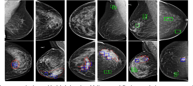 Figure 4 for A dual branch deep neural network for classification and detection in mammograms