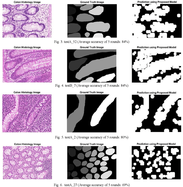 Figure 2 for Machine learning approach for segmenting glands in colon histology images using local intensity and texture features