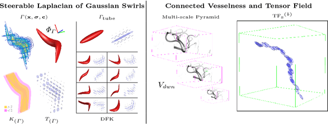 Figure 1 for VTrails: Inferring Vessels with Geodesic Connectivity Trees