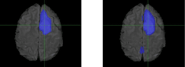 Figure 4 for Improvement of Multiparametric MR Image Segmentation by Augmenting the Data with Generative Adversarial Networks for Glioma Patients