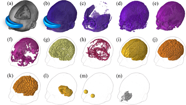 Figure 1 for Development of accurate human head models for personalized electromagnetic dosimetry using deep learning