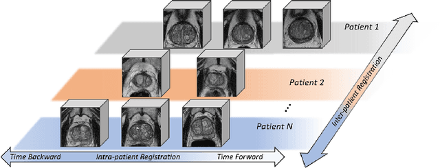 Figure 3 for Longitudinal Image Registration with Temporal-order and Subject-specificity Discrimination