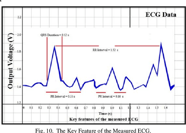 Figure 2 for Internet of Things based ECG System for Rural Health Care