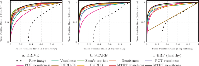 Figure 2 for Curvilinear Structure Enhancement by Multiscale Top-Hat Tensor in 2D/3D Images