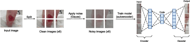 Figure 1 for Diabetic foot ulcers monitoring by employing super resolution and noise reduction deep learning techniques