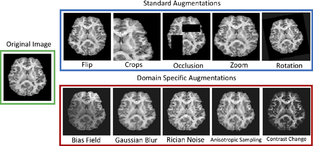 Figure 4 for Challenges for machine learning in clinical translation of big data imaging studies