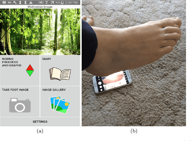 Figure 4 for Development of Diabetic Foot Ulcer Datasets: An Overview