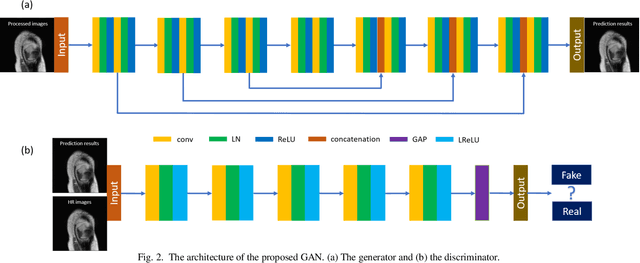 Figure 2 for MRI Super-Resolution with Ensemble Learning and Complementary Priors