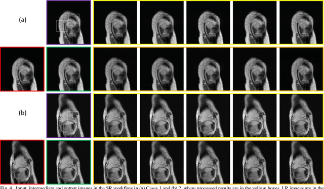 Figure 4 for MRI Super-Resolution with Ensemble Learning and Complementary Priors