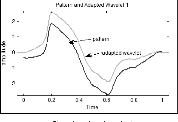 Figure 1 for Methodology For Detection of QRS Pattern Using Secondary Wavelets