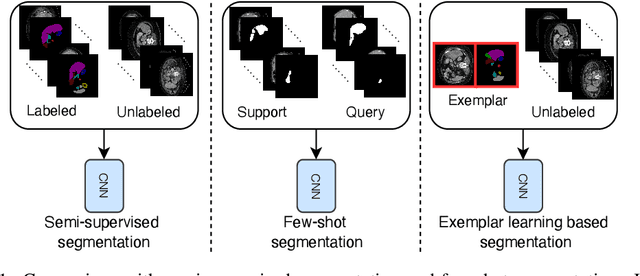 Figure 1 for Exemplar Learning for Medical Image Segmentation