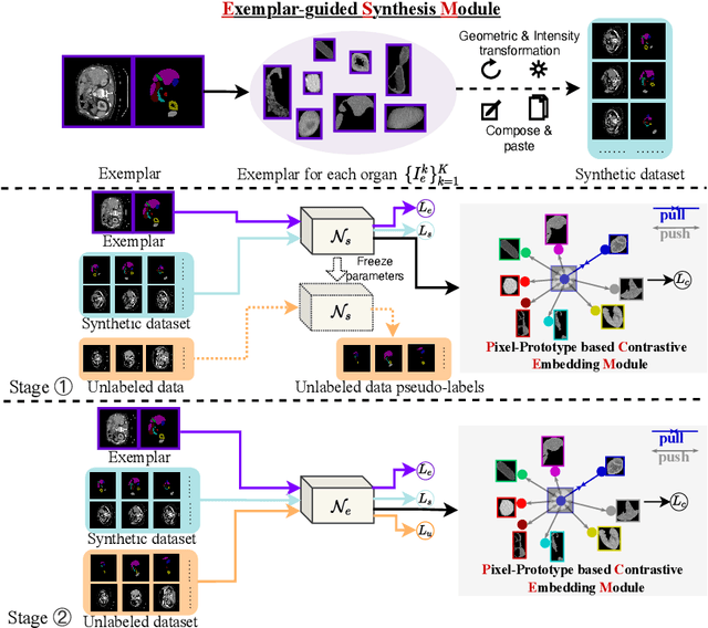 Figure 3 for Exemplar Learning for Medical Image Segmentation
