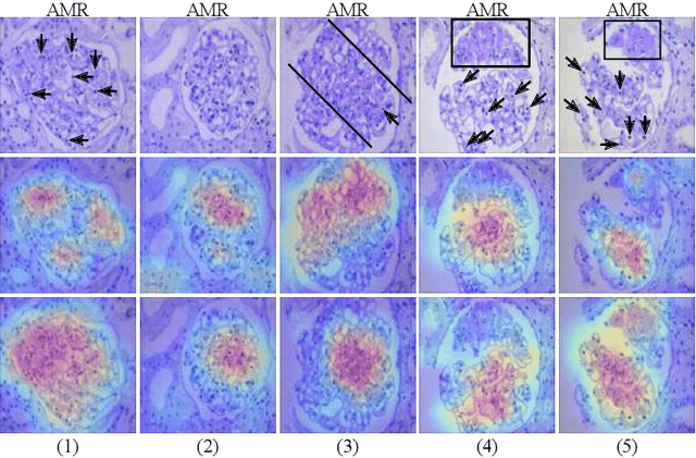 Figure 4 for StyPath: Style-Transfer Data Augmentation For Robust Histology Image Classification