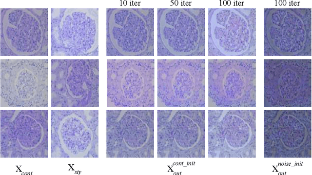Figure 1 for StyPath: Style-Transfer Data Augmentation For Robust Histology Image Classification