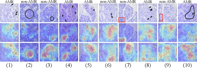 Figure 3 for StyPath: Style-Transfer Data Augmentation For Robust Histology Image Classification