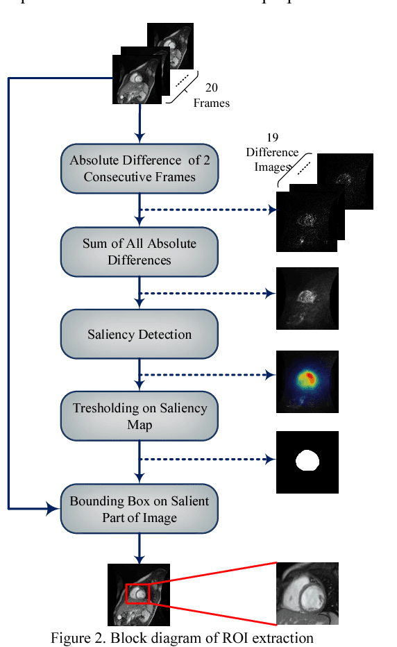 Figure 2 for Left Ventricle Segmentation in Cardiac MR Images Using Fully Convolutional Network