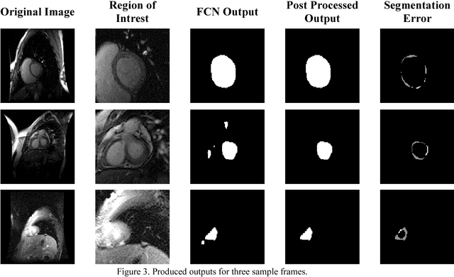 Figure 3 for Left Ventricle Segmentation in Cardiac MR Images Using Fully Convolutional Network