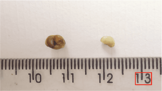 Figure 1 for Graph Relation Transformer: Incorporating pairwise object features into the Transformer architecture