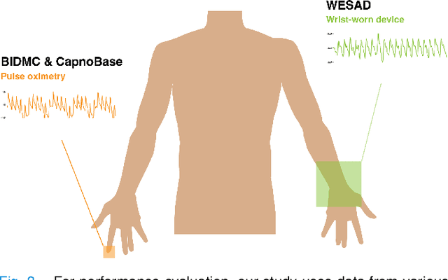 Figure 3 for RRWaveNet: A Compact End-to-End Multi-Scale Residual CNN for Robust PPG Respiratory Rate Estimation