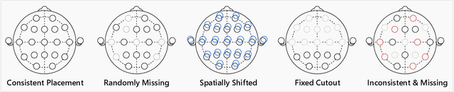 Figure 1 for Learning from Heterogeneous EEG Signals with Differentiable Channel Reordering