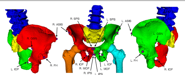 Figure 1 for Automatic Annotation of Hip Anatomy in Fluoroscopy for Robust and Efficient 2D/3D Registration