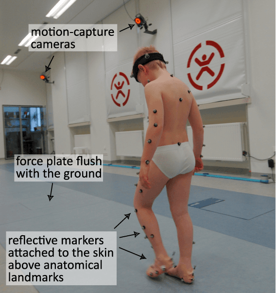 Figure 1 for Trustworthy Visual Analytics in Clinical Gait Analysis: A Case Study for Patients with Cerebral Palsy