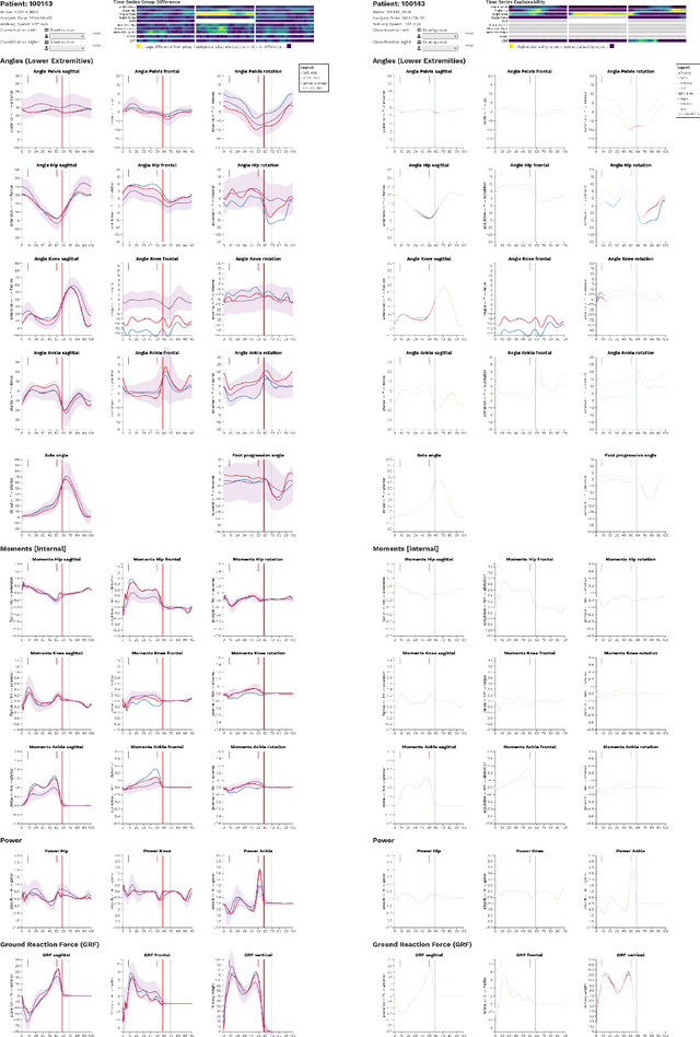 Figure 3 for Trustworthy Visual Analytics in Clinical Gait Analysis: A Case Study for Patients with Cerebral Palsy