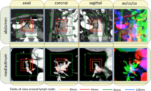 Figure 1 for Deep Convolutional Neural Networks for Computer-Aided Detection: CNN Architectures, Dataset Characteristics and Transfer Learning