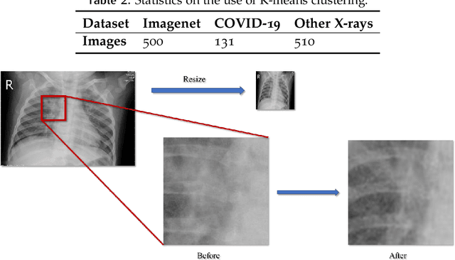 Figure 4 for A cascade network for Detecting COVID-19 using chest x-rays