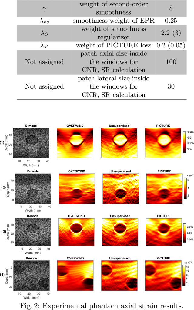 Figure 2 for Physically Inspired Constraint for Unsupervised Regularized Ultrasound Elastography