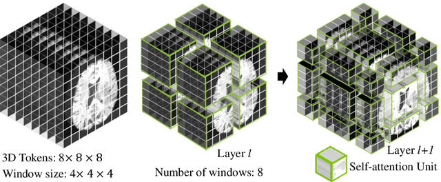 Figure 3 for Swin UNETR: Swin Transformers for Semantic Segmentation of Brain Tumors in MRI Images