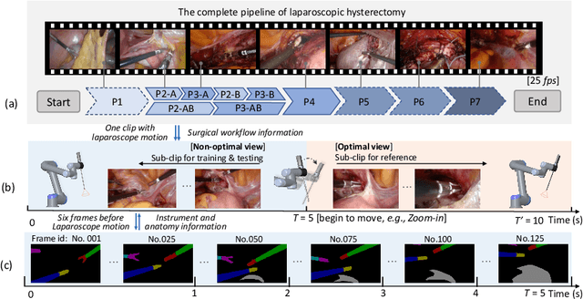 Figure 1 for AutoLaparo: A New Dataset of Integrated Multi-tasks for Image-guided Surgical Automation in Laparoscopic Hysterectomy