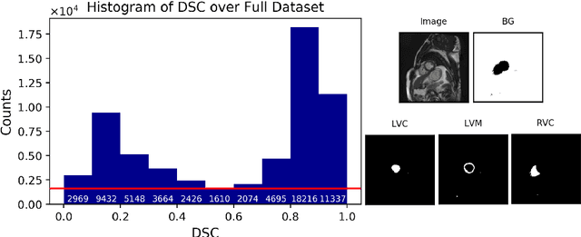 Figure 1 for Real-time Prediction of Segmentation Quality