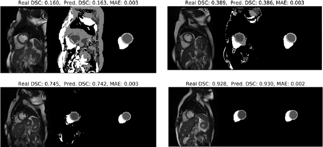 Figure 3 for Real-time Prediction of Segmentation Quality