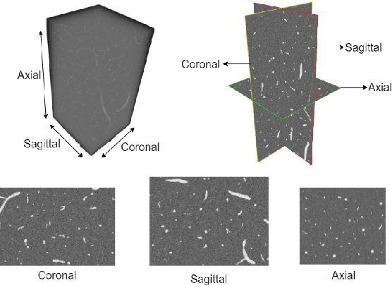 Figure 1 for MLP-GAN for Brain Vessel Image Segmentation
