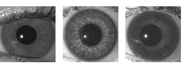 Figure 1 for Robust Iris Presentation Attack Detection Fusing 2D and 3D Information