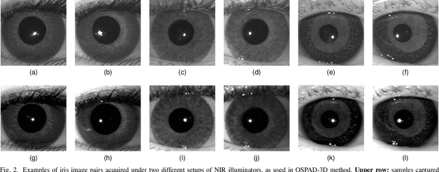 Figure 2 for Robust Iris Presentation Attack Detection Fusing 2D and 3D Information