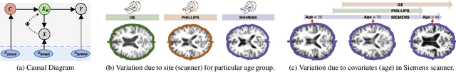 Figure 2 for Equivariance Allows Handling Multiple Nuisance Variables When Analyzing Pooled Neuroimaging Datasets